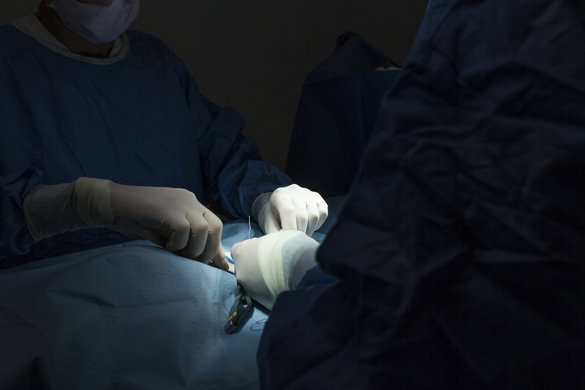 Résection tête et col du fémur chez le chien : causes, symptômes ...